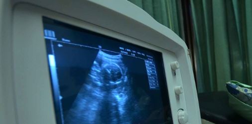 Bupati Purwakarta gratiskan Pemeriksaan USG pada ibu hamil